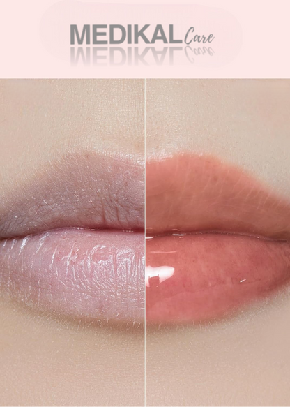 Aceite Labial Hidratante - Medikal Care
