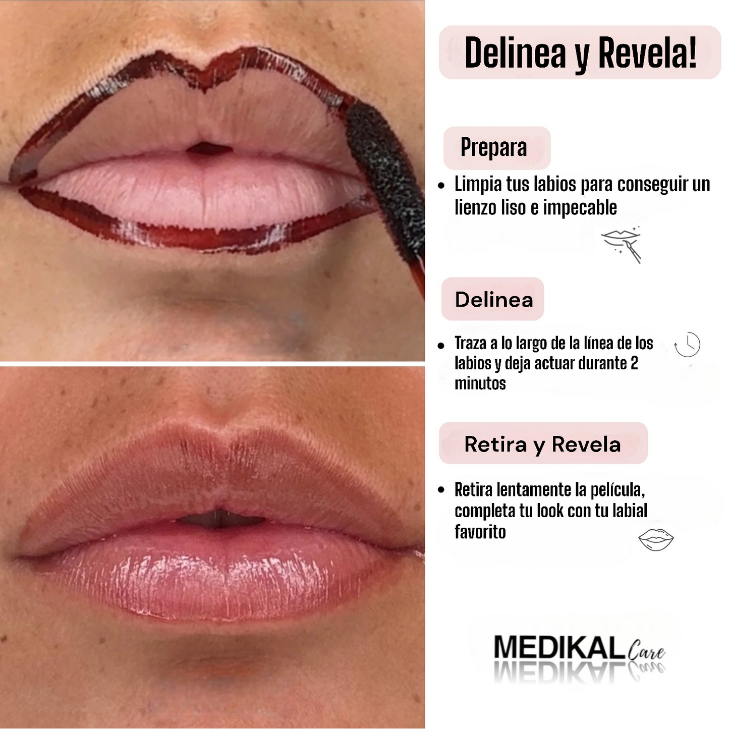 Lip Liner - Medical Care